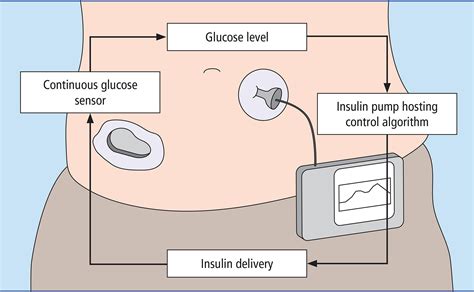 centrifugal pump in a closed loop system|best closed loop insulin pump.